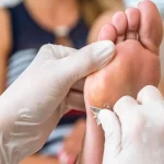 7 Cara Menghilangkan Kapalan di Telapak Kaki