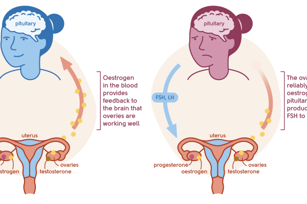 10 Cara Mengelola Hormon Selama Masa Menopause