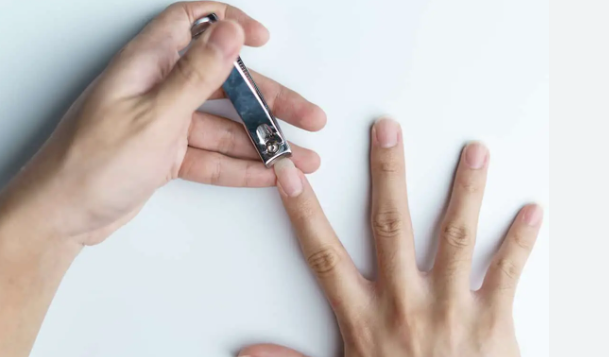 10 Cara Aman Potong Kuku agar Tidak Menyebabkan Luka