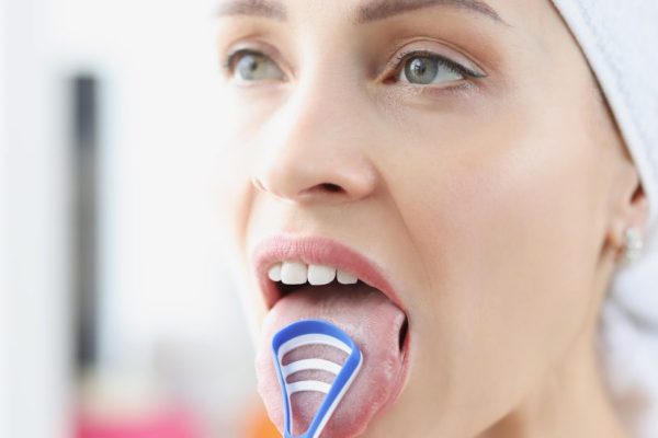 5 Alat Pembersih Lidah yang Praktis dan Efektif 5 Alat Pembersih Lidah yang Praktis dan Efektif