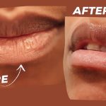 5 Cara Menyingkirkan Kulit Mati di Bibir Tanpa Sakit